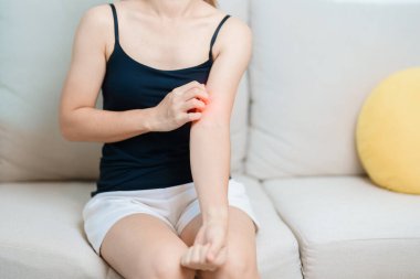 Kaşınan ve kaşınan bir kadın. Böcek ısırığına karşı hassas deri alerjisi, yemek, uyuşturucu dermatiti. Dermatoloji, cüzzam günü, sistemik lupus eritematoz, alerji semptomları ve isilik.
