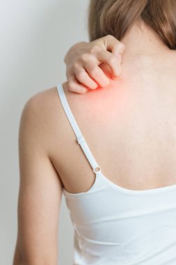 Kadın kaşınıyor ve sırtı kaşınıyor. Böcek ısırığına karşı hassas deri alerjisi, yemek, uyuşturucu dermatiti. Dermatoloji, cüzam, sistemik lupus eritematoz, alerji semptomları ve isilik.