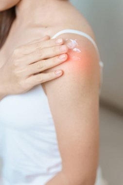 Eklem iltihabı ve kas ağrısı giderici krem konsepti. Omuz ve Kol ağrısı çeken bir kadın. Miyofasyal ağrı sendromu, fibromiyalji, romatizma, skapüler ağrı, boyun omurgası...