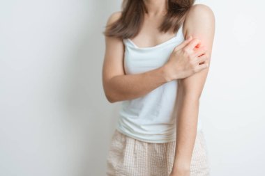 Kaşınan ve kaşınan bir kadın. Böcek ısırığına karşı hassas deri alerjisi, yemek, uyuşturucu dermatiti. Dermatoloji, cüzzam günü, sistemik lupus eritematoz, alerji semptomları ve isilik.
