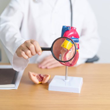 Doctor with human Heart anatomy model and magnifying glass. Cardiovascular Diseases, Atherosclerosis, Hypertensive Heart, Valvular Heart, Aortopulmonary window, world Heart day and health concept clipart