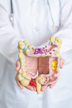 Doctor holding human Colon anatomy model. Colonic disease, Large Intestine, Colorectal cancer, Ulcerative colitis, Diverticulitis, Irritable bowel syndrome, Digestive system and Health concept clipart