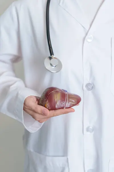 stock image Doctor holding human Liver anatomy model. Liver cancer and Tumor, Jaundice, Viral Hepatitis A, B, C, D, E, Cirrhosis, Failure, Enlarged, Hepatic Encephalopathy, Ascites Fluid in Belly and health