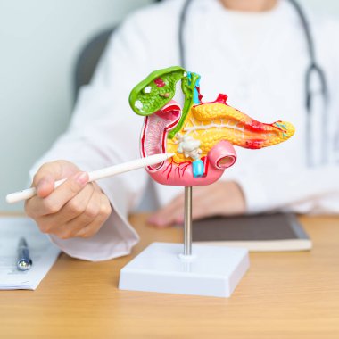 Pankreas, Safra kesesi, Bile Kanalı, Duodenum, ince bağırsak ve tablet olan insan pankreatiti anatomisi olan bir doktor. Pankreas kanseri, akut pankreas iltihabı ve sindirim sistemi.