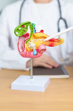 Pankreas, Safra kesesi, Bile Kanalı, Duodenum, ince bağırsak ve tablet olan insan pankreatiti anatomisi olan bir doktor. Pankreas kanseri, akut pankreas iltihabı ve sindirim sistemi.