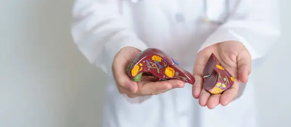 stock image Doctor holding human Liver anatomy model. Liver cancer and Tumor, Jaundice, Viral Hepatitis A, B, C, D, E, Cirrhosis, Failure, Enlarged, Hepatic Encephalopathy, Ascites Fluid in Belly and health