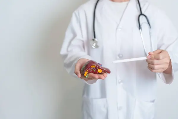 stock image Doctor holding human Liver anatomy model. Liver cancer and Tumor, Jaundice, Viral Hepatitis A, B, C, D, E, Cirrhosis, Failure, Enlarged, Hepatic Encephalopathy, Ascites Fluid in Belly and health