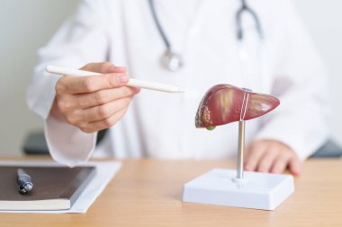 Karaciğer anatomisi modeli olan bir doktor. Karaciğer kanseri ve tümör, sarılık, Viral Hepatit A, B, C, D, E, Siroz, Başarısızlık, Büyümüş, Hepatik Ensefalopati, Karında Asit ve Sağlık Konsepti