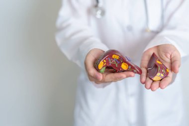Doctor holding human Liver anatomy model. Liver cancer and Tumor, Jaundice, Viral Hepatitis A, B, C, D, E, Cirrhosis, Failure, Enlarged, Hepatic Encephalopathy, Ascites Fluid in Belly and health clipart