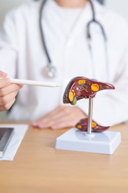Karaciğer anatomisi modeli olan bir doktor. Karaciğer kanseri ve tümör, sarılık, Viral Hepatit A, B, C, D, E, Siroz, Başarısızlık, Büyümüş, Hepatik Ensefalopati, Karında Asit ve Sağlık Konsepti