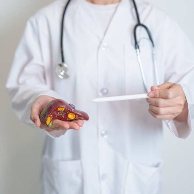 Doktor karaciğer anatomisi modelini tutuyor. Karaciğer kanseri ve tümör, sarılık, viral hepatit A, B, C, D, E, siroz, başarısızlık, büyümüş, Hepatik ensefalopati, mide sıvısı ve sağlık