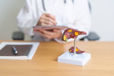 Karaciğer anatomisi modeli olan bir doktor. Karaciğer kanseri ve tümör, sarılık, Viral Hepatit A, B, C, D, E, Siroz, Başarısızlık, Büyümüş, Hepatik Ensefalopati, Karında Asit ve Sağlık Konsepti