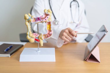 Kolon anatomisi modeli ve tableti olan bir doktor. Kolon hastalığı, kalın bağırsak kanseri, renk kanseri, ülseratif kolit, divertikülit, hassas bağırsak sendromu ve sindirim sistemi. 