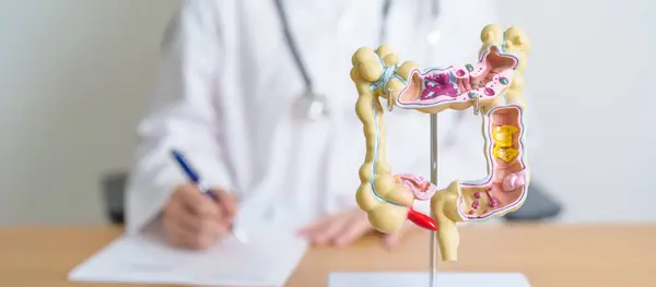 stock image Doctor with human Colon anatomy model. Colonic disease, Large Intestine, Colorectal cancer, Ulcerative colitis, Diverticulitis, Irritable bowel syndrome, Digestive system and Health concept