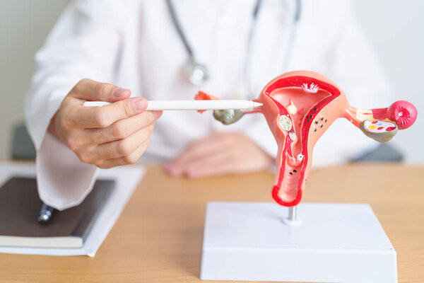 Доктор с моделью анатомии матки и яичников. Рак яичников и шейки матки, нарушение шейки матки, эндометриоз, гистерэктомия, миома матки, репродуктивная система, концепция беременности и здоровья