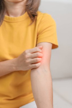 Kaşınan ve kaşınan bir kadın. Böcek ısırığına karşı hassas deri alerjisi, yemek, uyuşturucu dermatiti. Dermatoloji, cüzzam günü, sistemik lupus eritematoz, alerji semptomları ve isilik.