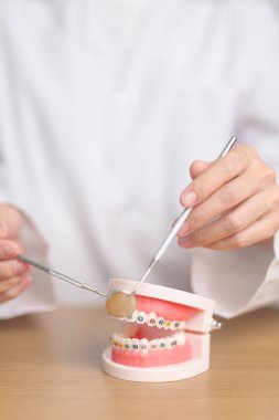 Ortodontik diş modelli, parantez ya da destekli bir diş hekimi. Tartarı temizleyin ve kazıyın. Mayıs Ortodonti Sağlık Günü, Mart Sağlığı, Diş Hekimleri Günü, Takma Diş. Diş Ağrısı ve Çocuk Diş Sağlığı