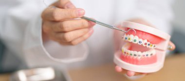 Ortodontik diş modelli, parantez ya da destekli bir diş hekimi. Tartarı temizleyin ve kazıyın. Mayıs Ortodonti Sağlık Günü, Mart Sağlığı, Diş Hekimleri Günü, Takma Diş. Diş Ağrısı ve Çocuk Diş Sağlığı