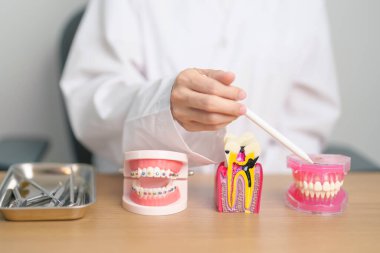 Diş Anatomisi ve ortodontik model dişçi masasında. Ağız Dişleri ve Hastalık. Mart Sağlığı, Diş Hekimi Günü, Takma Diş. Diş Ağrısı ve Çocuk Diş Sağlığı Ayı ve Mayıs Diş Sağlığı Günü