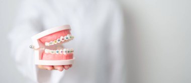 Ortodontik diş modelli, parantez ya da destekli bir diş hekimi. Tartarı temizleyin ve kazıyın. Mayıs Ortodonti Sağlık Günü, Mart Sağlığı, Diş Hekimleri Günü, Takma Diş. Diş Ağrısı ve Çocuk Diş Sağlığı