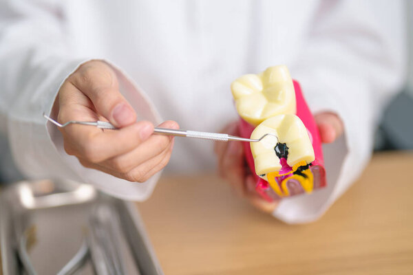 Dentist with tooth Anatomy model. Oral Teeth decay and disease, Scrape off tartar. March Oral health, Dentist Day, False Teeth. Toothache and Children Dental Health Month and Orthodontic Health Day