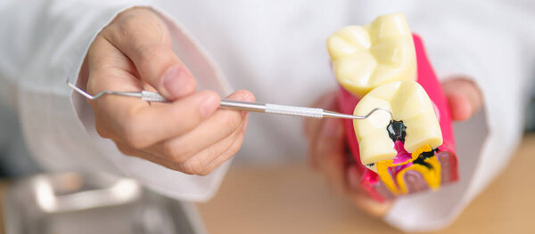 Dentist with tooth Anatomy model. Oral Teeth decay and disease, Scrape off tartar. March Oral health, Dentist Day, False Teeth. Toothache and Children Dental Health Month and Orthodontic Health Day