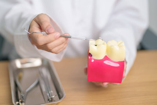Dentist with tooth Anatomy model. Oral Teeth decay and disease, Scrape off tartar. March Oral health, Dentist Day, False Teeth. Toothache and Children Dental Health Month and Orthodontic Health Day