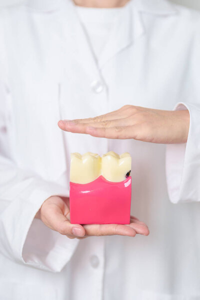 Dentist with tooth Anatomy model. Oral Teeth decay and disease, Scrape off tartar. March Oral health, Dentist Day, False Teeth. Toothache and Children Dental Health Month and Orthodontic Health Day