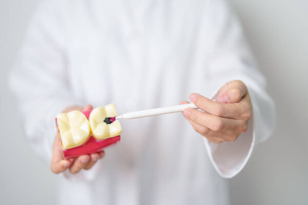 Dentist with tooth Anatomy model. Oral Teeth decay and disease, Scrape off tartar. March Oral health, Dentist Day, False Teeth. Toothache and Children Dental Health Month and Orthodontic Health Day