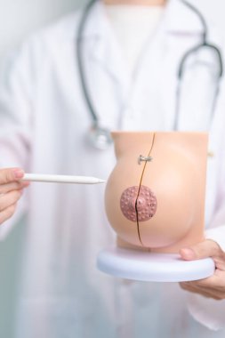 Doktor göğüs anatomisi modelini tutuyor. Göğüs büyütme ameliyatı, Ekim Kanser Farkındalığı ayı, implant, teşhis, kadın büyütme ve tıp eğitimi konsepti.