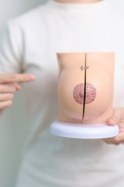 Göğüs Anatomisi modelini tutan kadın. Göğüs büyütme ameliyatı, Ekim Kanser Farkındalığı ayı, implant, teşhis, kadın büyütme ve tıp eğitimi konsepti.