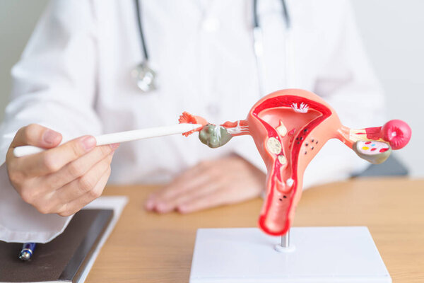 Доктор с моделью анатомии матки и яичников. Рак яичников и шейки матки, нарушение шейки матки, эндометриоз, гистерэктомия, миома матки, репродуктивная система, концепция беременности и здоровья