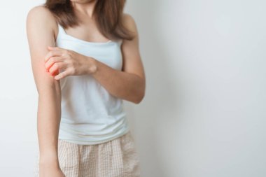 Kaşınan ve kaşınan bir kadın. Böcek ısırığına karşı hassas deri alerjisi, yemek, uyuşturucu dermatiti. Dermatoloji, cüzzam günü, sistemik lupus eritematoz, alerji semptomları ve isilik.
