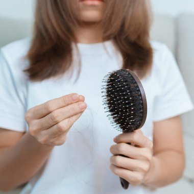 Saç dökülme sorunu, Kellik, Güzellik ve Sağlık Bakım Konseptleri, elinde saç dökülmesi tarak tutan Asyalı kadın, saç fırçası tutan ve kafa derisinden dökülen saçlarla fırçalayan genç kadın.