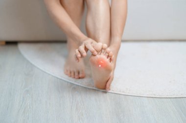 Eklem iltihabı ve kas ağrısı giderici krem konsepti. Evde yalınayak acı çeken bir kadın. Ayak ağrısı Plantar fasiiti ve uzun zamandır uyanık. Sağlık ve Sağlık