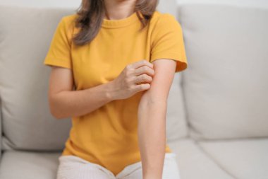 Kaşınan ve kaşınan bir kadın. Böcek ısırığına karşı hassas deri alerjisi, yemek, uyuşturucu dermatiti. Dermatoloji, cüzzam günü, sistemik lupus eritematoz, alerji semptomları ve isilik.