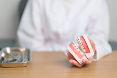 Ortodontik diş modelli, parantez ya da destekli bir diş hekimi. Tartarı temizleyin ve kazıyın. Mayıs Ortodonti Sağlık Günü, Mart Sağlığı, Diş Hekimleri Günü, Takma Diş. Diş Ağrısı ve Çocuk Diş Sağlığı