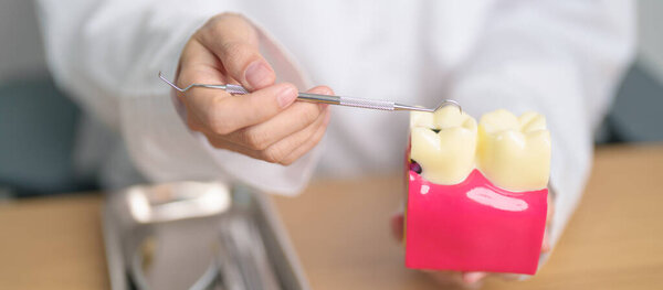 Dentist with tooth Anatomy model. Oral Teeth decay and disease, Scrape off tartar. March Oral health, Dentist Day, False Teeth. Toothache and Children Dental Health Month and Orthodontic Health Day