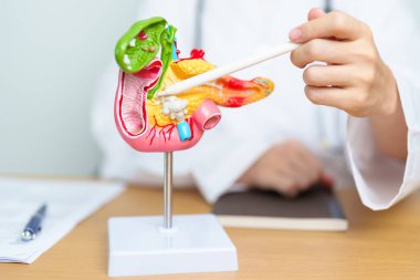 Pankreas, Safra kesesi, Bile Kanalı, Duodenum, ince bağırsak ve tablet olan insan pankreatiti anatomisi olan bir doktor. Pankreas kanseri, akut pankreas iltihabı ve sindirim sistemi.
