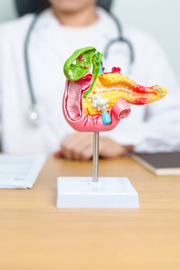 Pankreas, safra kesesi, Bile Duct, Duodenum, ince bağırsak ile insan pankreatiti anatomisi modeli olan bir doktor. Pankreas kanseri, Akut ve Kronik pankreas iltihabı, Sindirim Sistemi ve Sağlık Konsepti