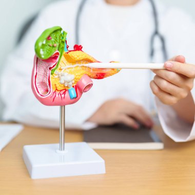 Pankreas, Safra kesesi, Bile Kanalı, Duodenum, ince bağırsak ve tablet olan insan pankreatiti anatomisi olan bir doktor. Pankreas kanseri, akut pankreas iltihabı ve sindirim sistemi.