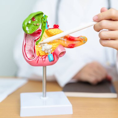 Pankreas, Safra kesesi, Bile Kanalı, Duodenum, ince bağırsak ve tablet olan insan pankreatiti anatomisi olan bir doktor. Pankreas kanseri, akut pankreas iltihabı ve sindirim sistemi.
