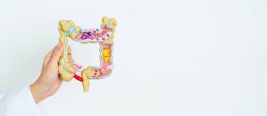 İnsan kolon anatomisi modeli olan bir doktor. Kolon hastalığı, kalın bağırsak kanseri, renk kanseri, ülseratif kolit, divertikülit, hassas bağırsak sendromu, sindirim sistemi ve sağlık konsepti.