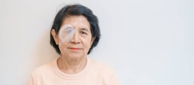 Göz ameliyatından sonra koruyucu kalkanı olan yaşlı bir kadın. Göz hastalığı, Katarakt, Glaukoma, Yaşla İlgili Maküler Dejenerasyon, Diyabetik Retinopati, Vitreous, Lasik, Dünya Glaukoma Günü ve Sağlık 