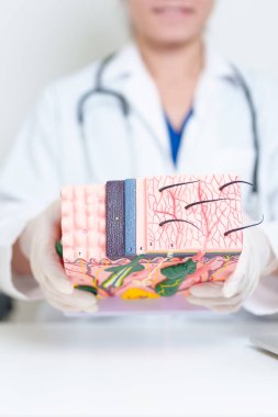 Saçlı insan derisinin anatomisi modeli olan bir dermatolog. Doktor deri, deri hastalığı ve saç kaybının yapısını gösteriyor. Sağlık, cilt bakımı, estetik cerrahi ve güzellik danışmanlığı