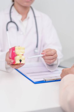 Yaşlı Hasta Diş Hastalıkları Danışmanı, Kıdemli Sağlık Sağlığı Teşhisi. Ağız çürüğü için anatomi diş modeli, tartarı kazıyın. Mart Sağlığı, Diş Hekimleri Günü, Takma Diş Konsepti 