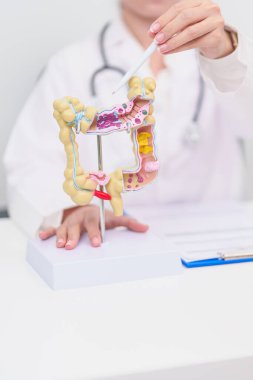 Kolon hastalığı, kalın bağırsak, renk kanseri, ülseratif kolit, divertikülit, hassas bağırsak sendromu, sindirim sistemi ve sağlık hizmetleri için yaşlı kadın hasta danışmanlığı 