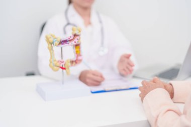 Kolon hastalığı, kalın bağırsak, renk kanseri, ülseratif kolit, divertikülit, hassas bağırsak sendromu, sindirim sistemi ve sağlık hizmetleri için yaşlı kadın hasta danışmanlığı 