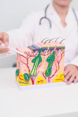 Cilt ve saç anatomisi olan kadın dermatolog. Cilt hastalığı ve saç kaybı, Sistemik Lupus Eritematoz veya SLE, dünya lupus günü, Mayıs Melanoma ve Cilt Kanseri Bilinci Ayı