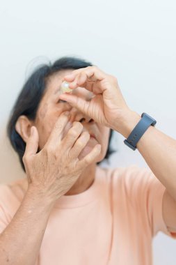 Yaşlı kadın göz ameliyatından sonra optalmik çözümler ya da göz damlası kullanır. Göz hastalığı, Katarakt, Glaukoma, Yaşla İlgili Maküler Dejenerasyon, Diyabetik Retinopati, Dünya Glaukoma Günü ve Sağlık Tedavisi